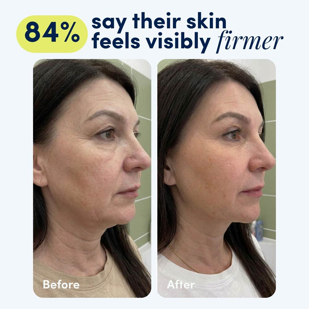 Naraskin Lab Instant-Effect Firming Cream For Neck & Face 3